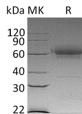 Recombinant Mouse CD27/TNFRSF7 Protein (Fc & His Tag) - ABMIUM