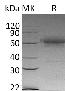 Recombinant Mouse CD27/TNFRSF7 Protein (Fc & His Tag) - ABMIUM