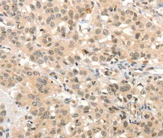Anti-Human TSPYL2 Antibody
