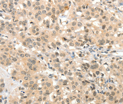 Anti-Human TSPYL2 Antibody - ABMIUM