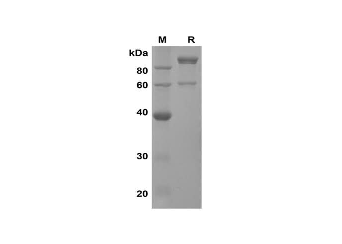 SDS-PAGE analysis of Human MMP-2 proteins, 2 μg/lane of Recombinant Human MMP-2 proteins was resolved with SDS-PAGE under reducing conditions, showing bands at 100-110 kDa.