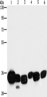 Anti-Human/Mouse/Rat CBR1 Antibody - ABMIUM