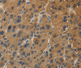 Anti-Human/Mouse DUSP23 Antibody - ABMIUM