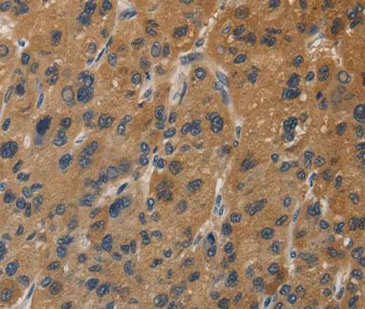 Anti-Human/Mouse DUSP23 Antibody