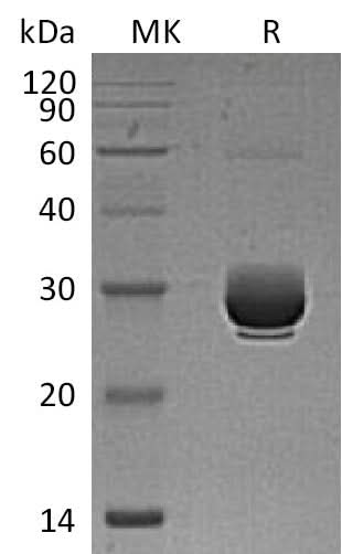 Recombinant Mouse ANGPTL3 Protein (His Tag) - ABMIUM