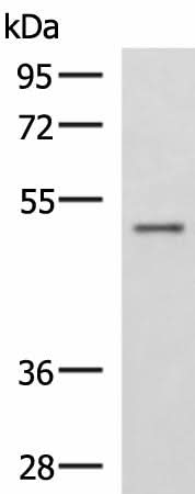 Western blot analysis of Human placenta tissue lysate using GRWD1 Polyclonal Antibody at dilution of 1:800