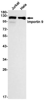 Western blot detection of Importin 9/RANBP9 in Jurkat,Hela cell lysates using Importin 9/RANBP9 Rabbit mAb(1:1000 diluted).Predicted band size:115kDa.Observed band size:115kDa.