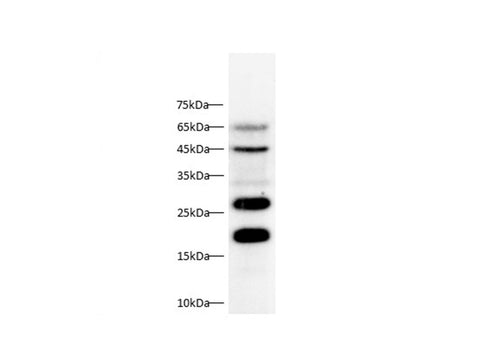 Anti-Human CTSB Antibody - ABMIUM