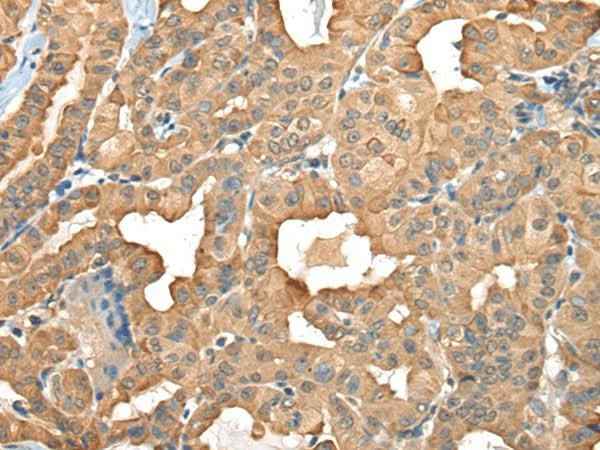 Anti-Human/Mouse/Rat C1GALT1C1 Antibody