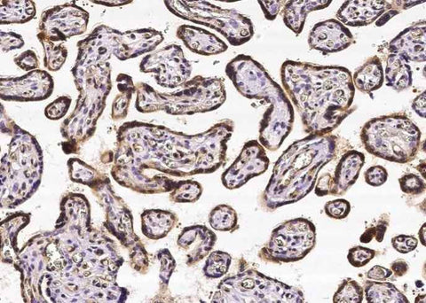 Anti-Human CRIP2 Antibody [A994] - ABMIUM