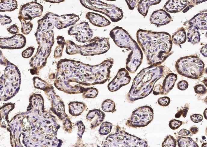 Anti-Human CRIP2 Antibody [A994] - ABMIUM