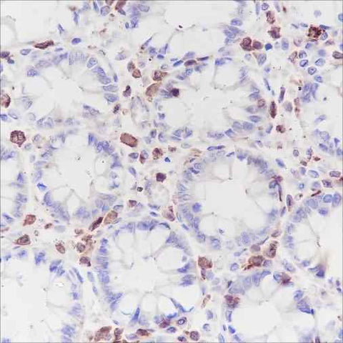 Anti-Human/Mouse CSF-1R Antibody [A195] - ABMIUM