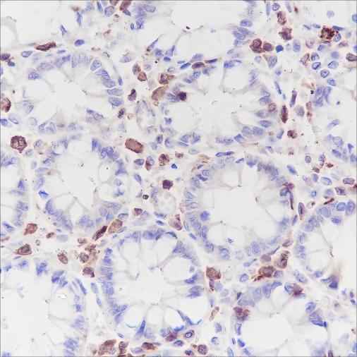 Anti-Human/Mouse CSF-1R Antibody [A195] - ABMIUM