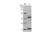 SDS-PAGE analysis of Rat S100A9 proteins, 2 μg/lane of Recombinant Rat S100A9 proteins was resolved with SDS-PAGE under reducing conditions, showing bands at 15.24 kDa.