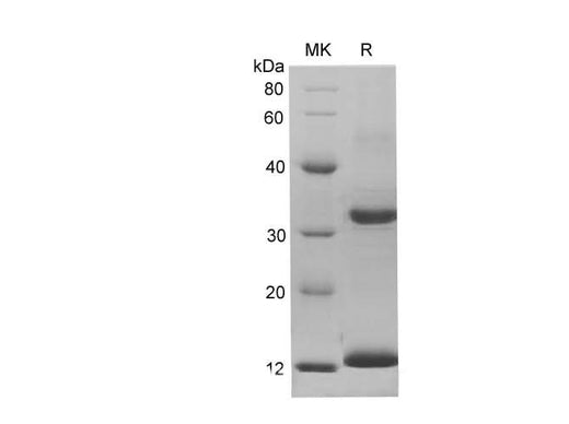 SDS-PAGE analysis of Rat S100A9 proteins, 2 μg/lane of Recombinant Rat S100A9 proteins was resolved with SDS-PAGE under reducing conditions, showing bands at 15.24 kDa.