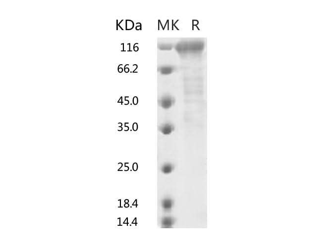 Recombinant SARS-CoV-2 S2 Protein (ECD, Fc Tag) - ABMIUM