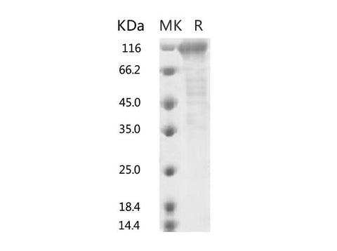 Recombinant SARS-CoV-2 S2 Protein (ECD, Fc Tag) - ABMIUM