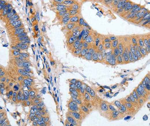 Anti-Human/Mouse/Rat HSPA1A Antibody