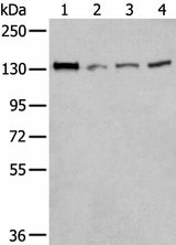 Western blot analysis of 293T Hela and A172 cell lysates using MORC2 Polyclonal Antibody at dilution of 1:300