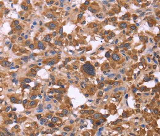 Anti-Human/Mouse FBXW7 Antibody