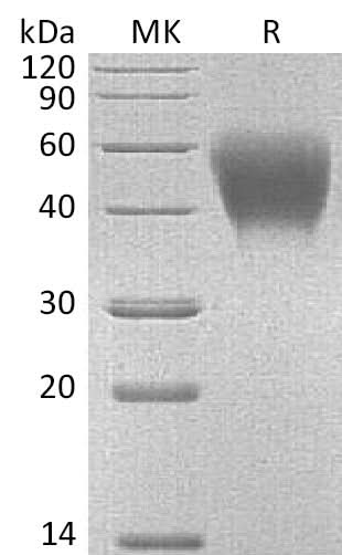 Recombinant Mouse CD150/SLAM Protein (His Tag) - ABMIUM