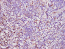 Anti-Human CD74 Antibody - ABMIUM