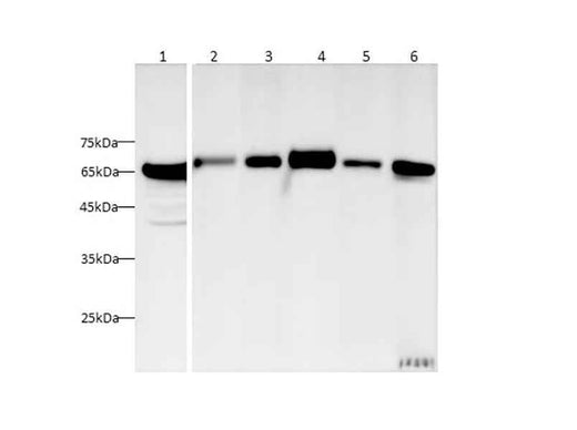 Anti-Human/Mouse/Rat HSP-60 Antibody - ABMIUM