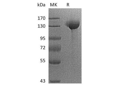 Recombinant Human SIGLEC2/CD22 Protein (Fc Tag) - ABMIUM