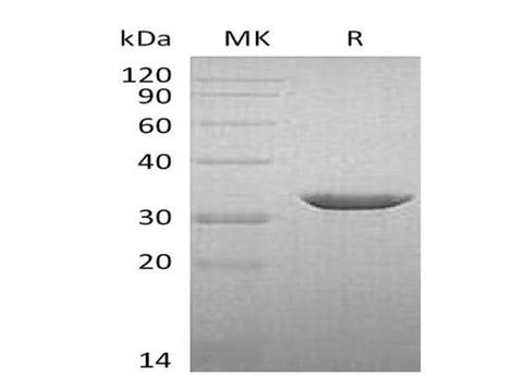 Recombinant Human B3GAT3 Protein (His Tag) - ABMIUM