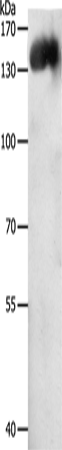 Anti-Human/Mouse CD31 Antibody - ABMIUM