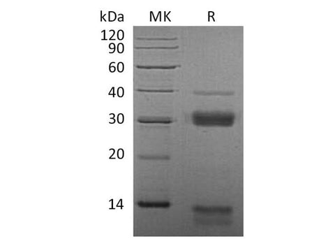 Recombinant Mouse Cathepsin S/CTSS Protein (His Tag) - ABMIUM
