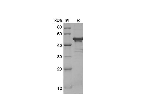 SDS-PAGE analysis of Mouse IL-11 proteins, 2 μg/lane of Recombinant Mouse IL-11 proteins was resolved with SDS-PAGE under reducing conditions, showing bands at 45 kDa.