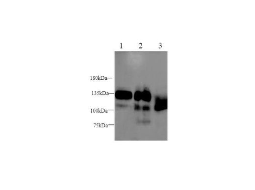 Anti-Human/Mouse/Rat SEMA4D Antibody - ABMIUM