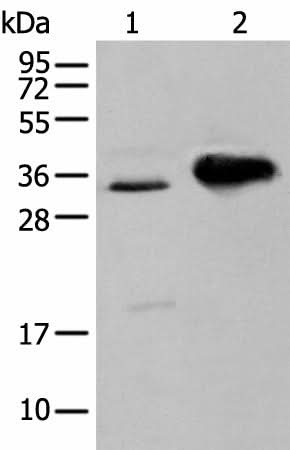 Western blot analysis of TM4 cell and Mouse brain tissue using ATP6V1E2 Polyclonal Antibody at dilution of 1:400