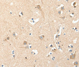 Anti-Human/Mouse/Rat RRAD Antibody - ABMIUM