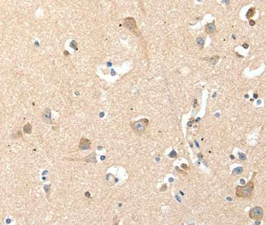 Anti-Human/Mouse/Rat RRAD Antibody