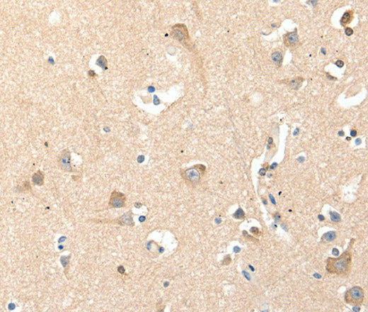 Anti-Human/Mouse/Rat RRAD Antibody - ABMIUM