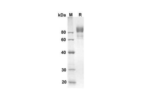 SDS-PAGE analysis of Mouse Cd6 proteins, 2 μg/lane of Recombinant Mouse Cd6 proteins was resolved with an SDS-PAGE under reducing conditions, showing bands at 66.9 kDa.