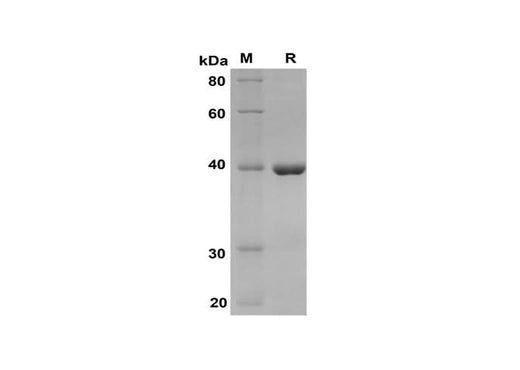 SDS-PAGE analysis of Human S100A8 proteins, 2 μg/lane of Recombinant Human S100A8 proteins was resolved with SDS-PAGE under reducing conditions, showing bands at 40 kDa.
