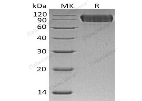 Recombinant Human Neuroligin 1/NLGN1 Protein (His Tag) - ABMIUM