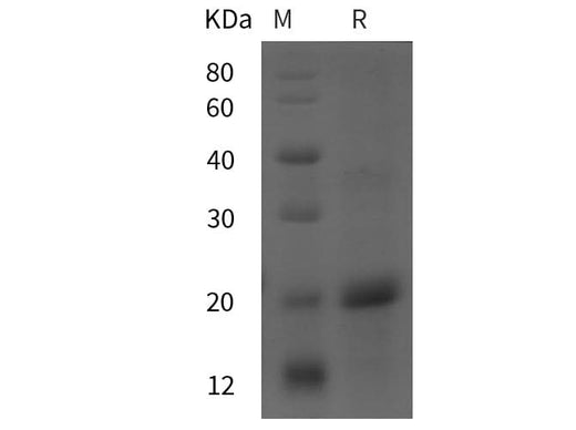 SDS-PAGE analysis of Rat MCP-1 proteins, 2 μg/lane of Recombinant Rat MCP-1 proteins was resolved with SDS-PAGE under reducing conditions, showing bands at 20 kDa.