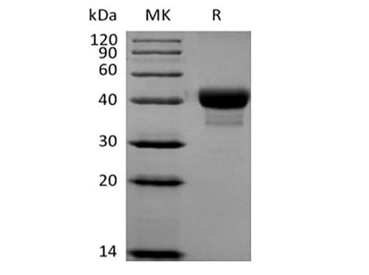Recombinant Human CD52 (C-Fc-Avi) Biotinylated - ABMIUM