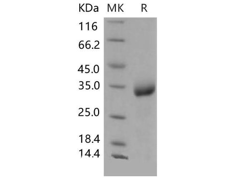 Recombinant Mouse CHODL/Chondrolectin Protein (His Tag) - ABMIUM