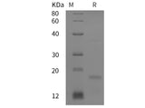 SDS-PAGE analysis of Human P21 proteins, 2 μg/lane of Recombinant Human P21 proteins was resolved with SDS-PAGE under reducing conditions, showing bands at 18 kDa.