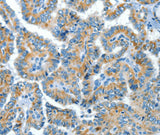 Anti-Human COG1 Antibody - ABMIUM