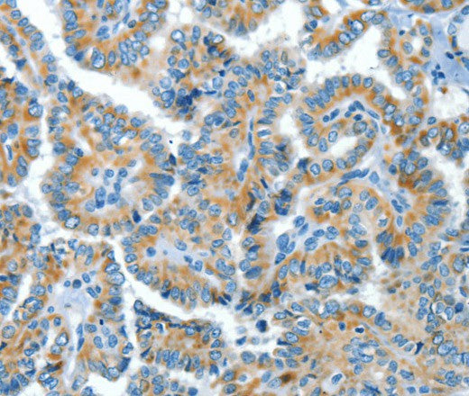 Anti-Human COG1 Antibody - ABMIUM