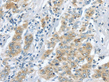 Anti-Human/Mouse LRP6 Antibody - ABMIUM