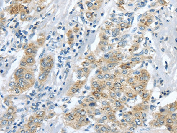 Anti-Human/Mouse LRP6 Antibody - ABMIUM