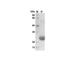 SDS-PAGE analysis of Mouse CXCL3/CINC-2α/β proteins, 2 μg/lane of Recombinant Mouse CXCL3/CINC-2α/β proteins was resolved with SDS-PAGE under reducing conditions, showing bands at 25 kDa.