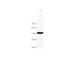 Anti-Human DNase-Ⅰ Antibody - ABMIUM